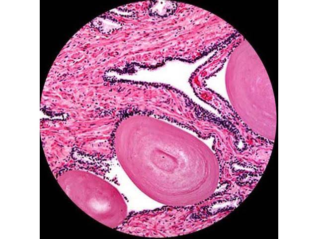 40X-2000X LED Monocular Compound Microscope with 9MP Camera U9387